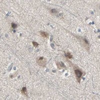 HPA IHC Cerebral cortex — TRPV4