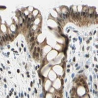 HPA IHC Colon — NELFE