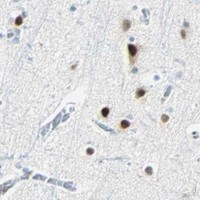 HPA IHC Cerebral cortex — NELFE