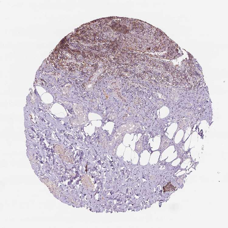 Tissue expression of GPRC5D Staining in appendix The Human Protein