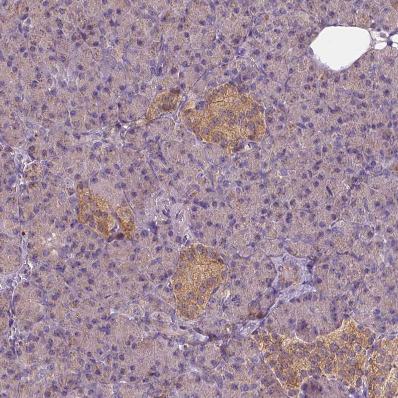 GPRC5D Antibodies The Human Protein Atlas