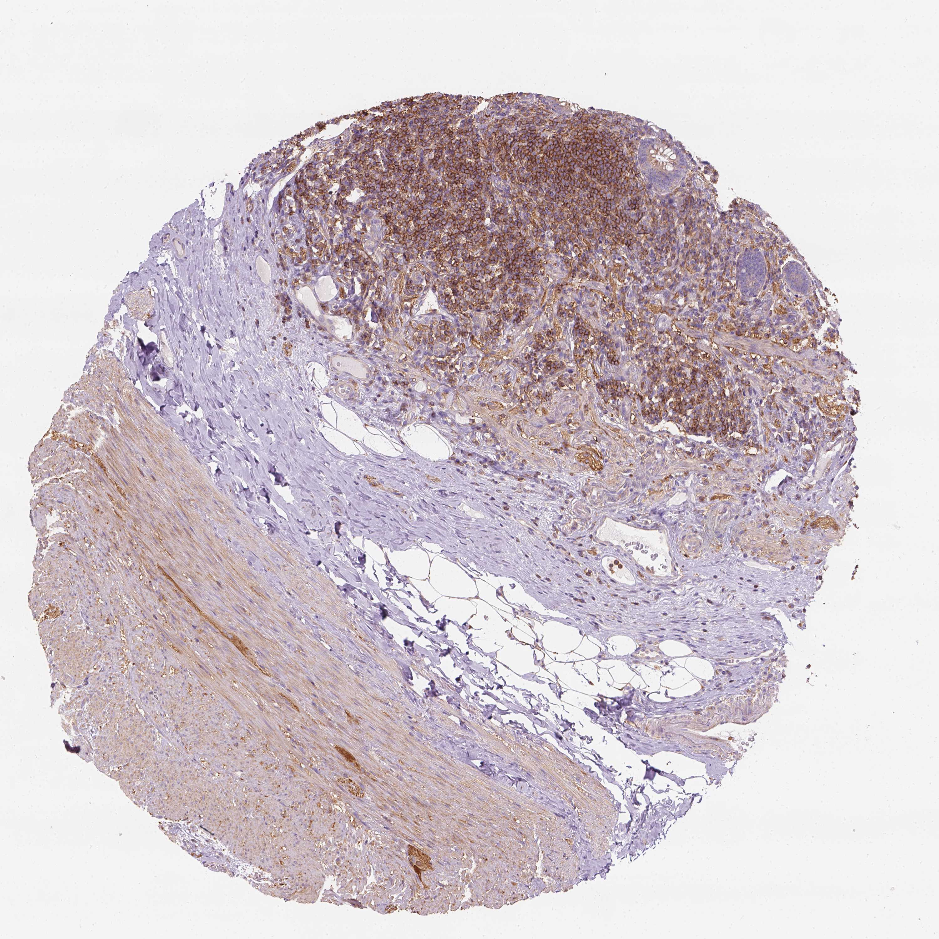 Tissue expression of GPRC5D Staining in appendix The Human Protein
