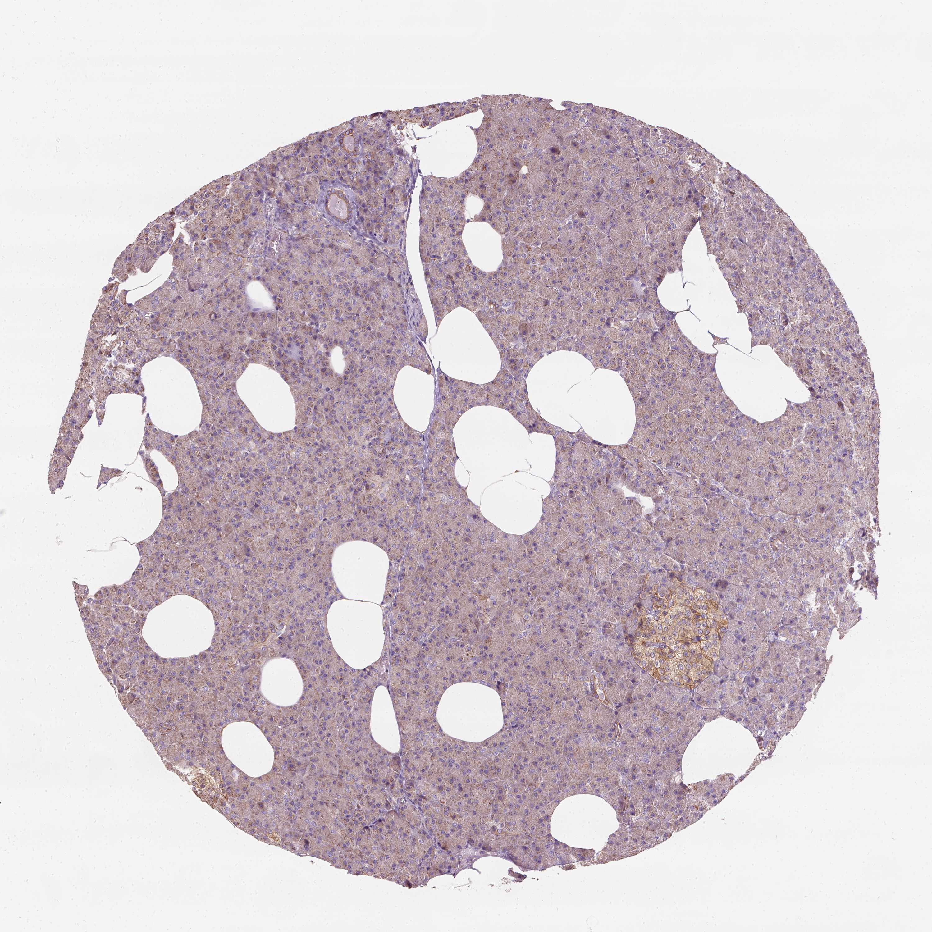 Tissue expression of GPRC5D Staining in pancreas The Human Protein