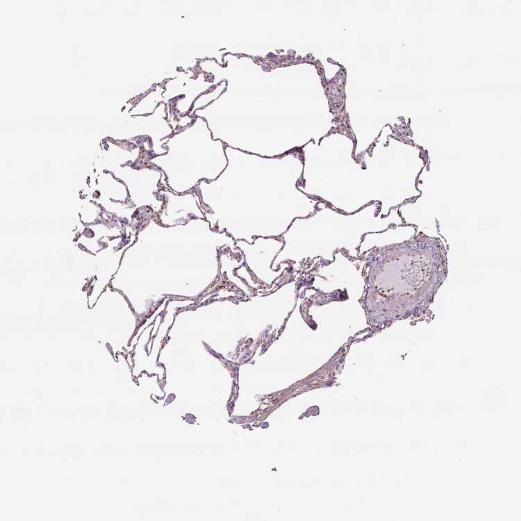 Tissue expression of GPRC5D Staining in lung The Human Protein Atlas