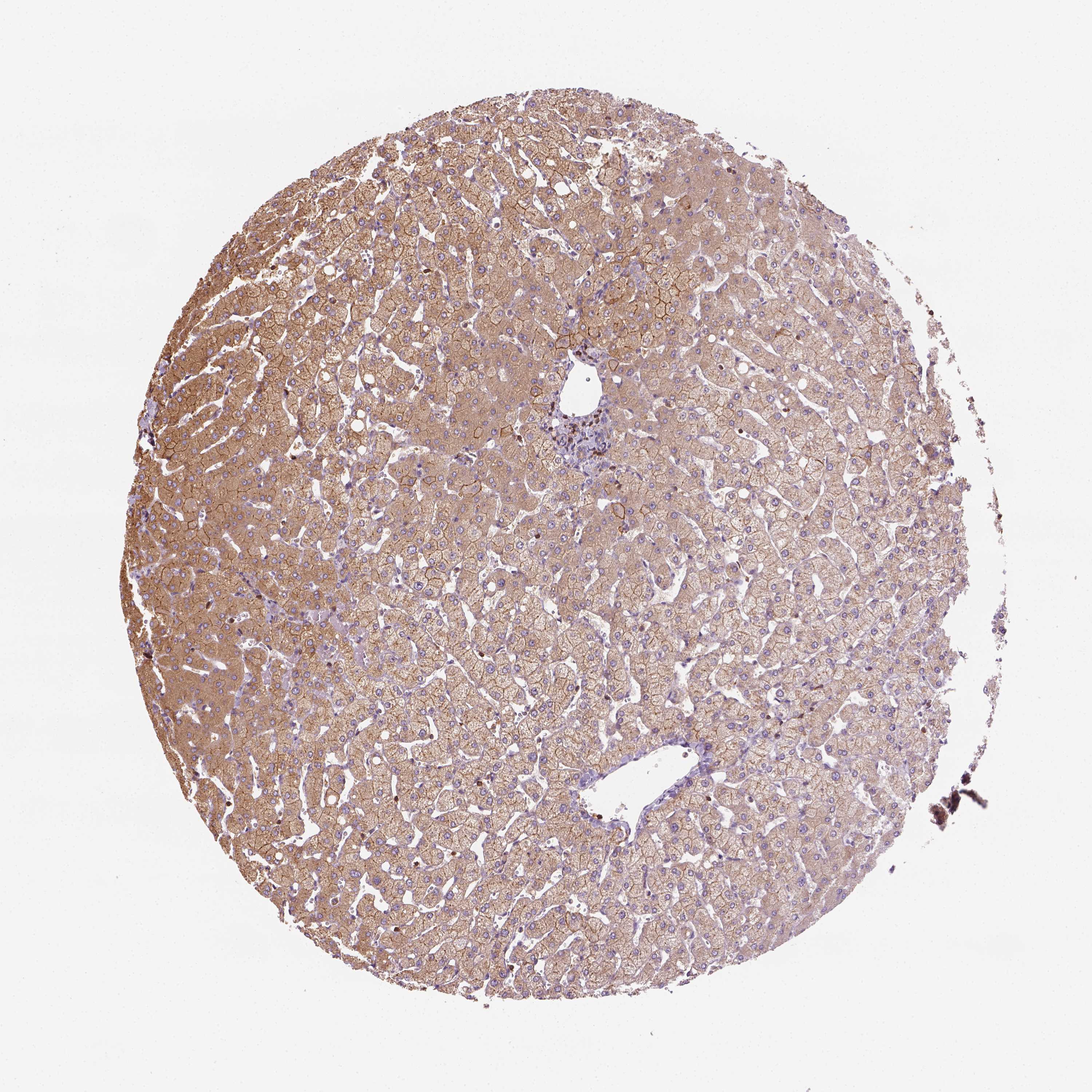 Tissue expression of GPRC5D Staining in liver The Human Protein Atlas