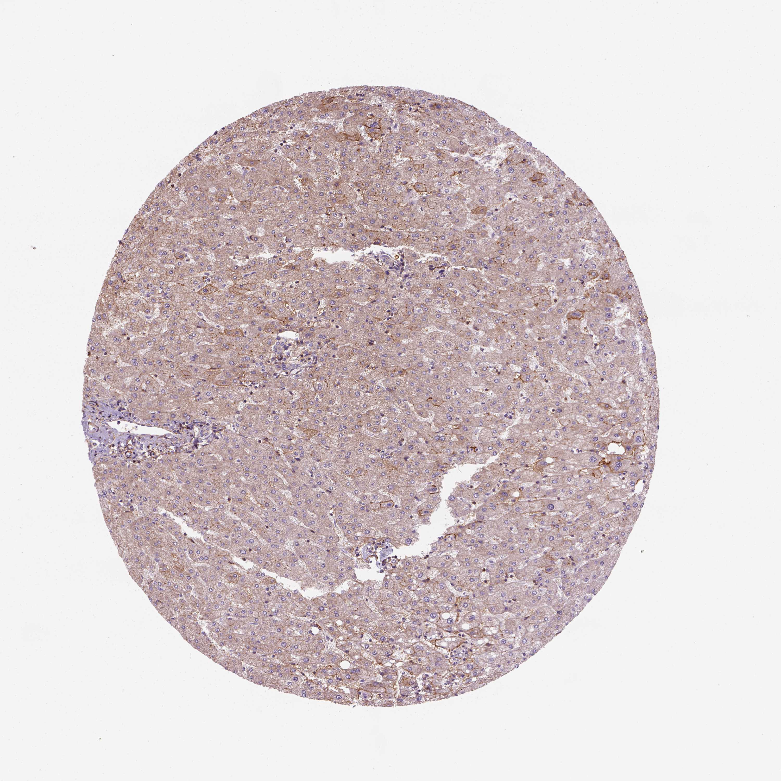 Tissue expression of GPRC5D Staining in liver The Human Protein Atlas