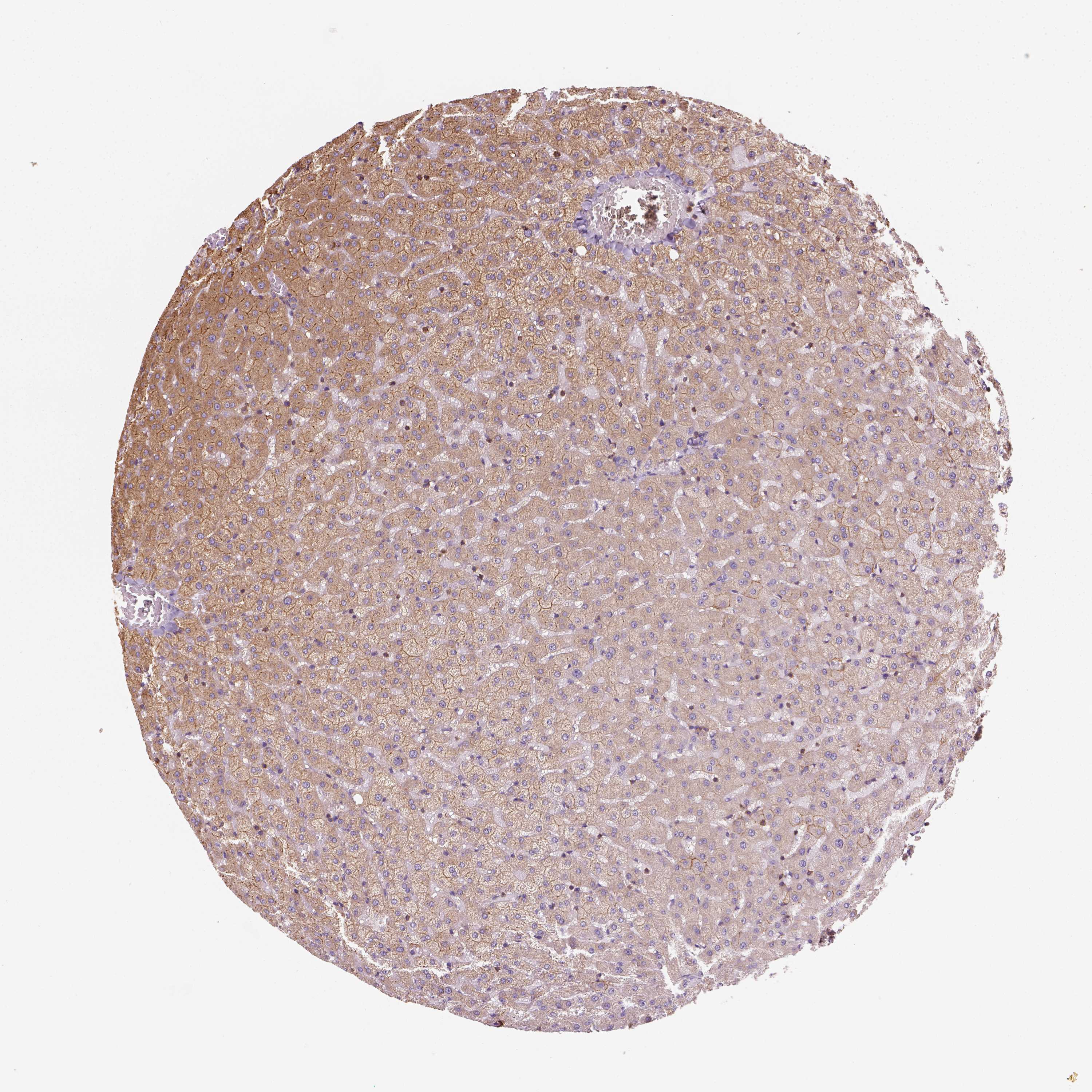 Tissue expression of GPRC5D Staining in liver The Human Protein Atlas