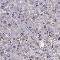HPA IHC Liver — SCARB1