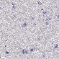 HPA IHC Cerebral cortex — SCARB1