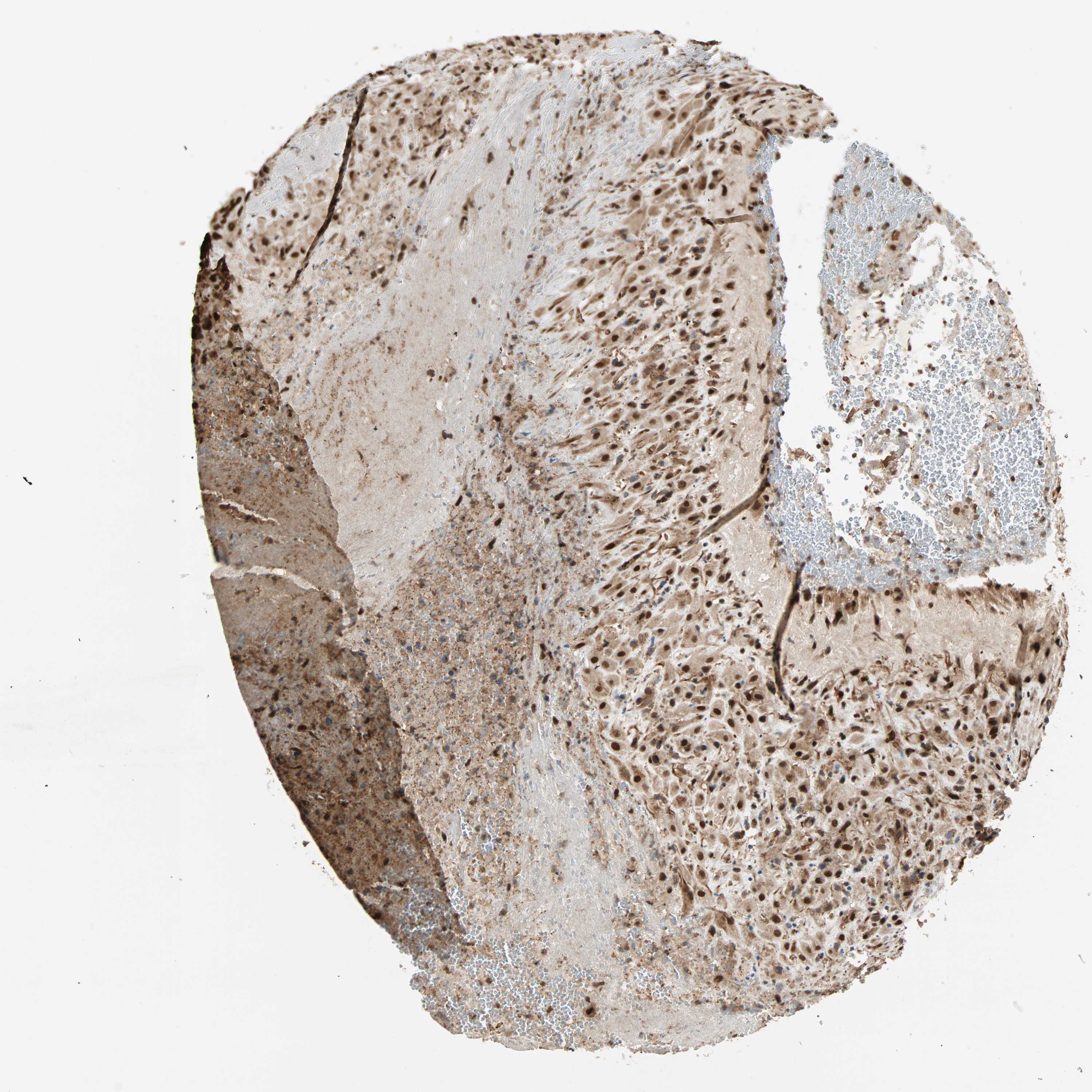 Tissue expression of ZBED9 - Staining in Placenta - The