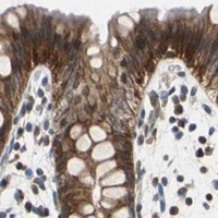 HPA IHC Colon — LSR