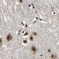 HPA IHC Cerebral cortex — LSR
