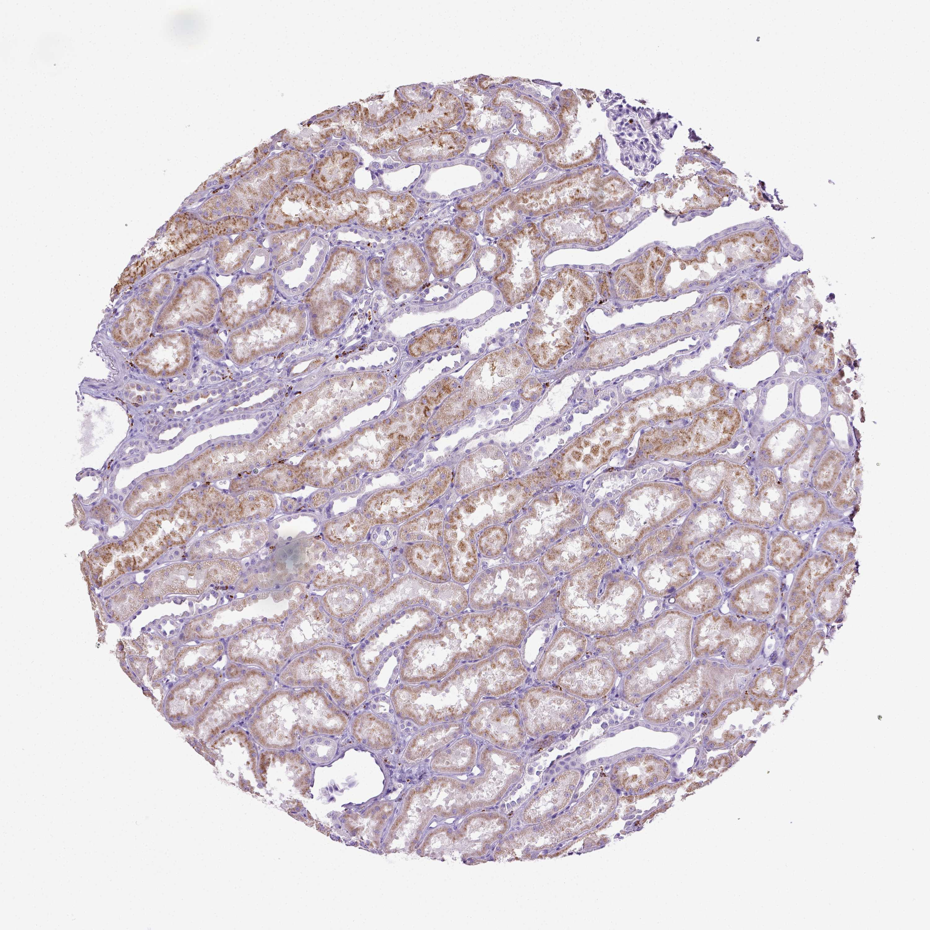 Tissue expression of CD68 - Staining in kidney - The Human Protein Atlas