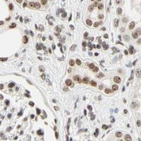 HPA IHC Kidney — ZSCAN16