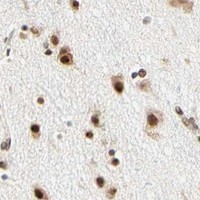 HPA IHC Cerebral cortex — ZSCAN16