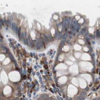 HPA IHC Colon — SLC27A4