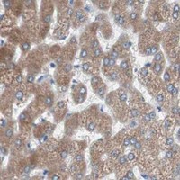 HPA IHC Liver — SLC27A4