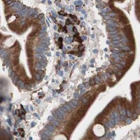 HPA IHC Duodenum — SLC27A4