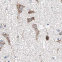 HPA IHC Cerebral cortex — SLC27A4