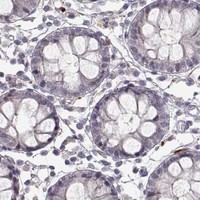 HPA IHC Colon — S100B