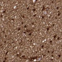 HPA IHC Cerebral cortex — S100B