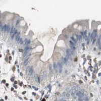 HPA IHC Colon — CALB2