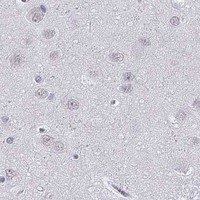 HPA IHC Cerebral cortex — PPP1R3A