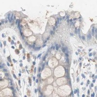 HPA IHC Colon — GLUL