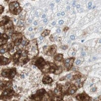 HPA IHC Liver — GLUL