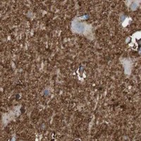 HPA IHC Cerebral cortex — GLUL
