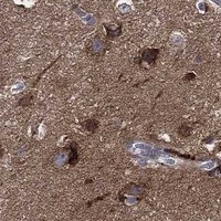 HPA IHC Cerebral cortex — STK3