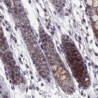 HPA IHC Colon — NUP37