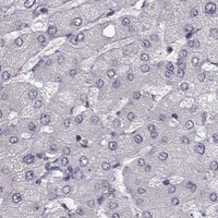 HPA IHC Liver — NUP37