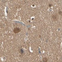HPA IHC Cerebral cortex — PNCK