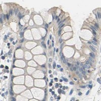 HPA IHC Colon — ROCK2