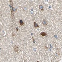 HPA IHC Cerebral cortex — ROCK2