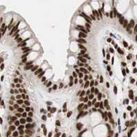 HPA IHC Colon — ILF2