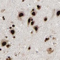 HPA IHC Cerebral cortex — ILF2