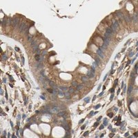 HPA IHC Colon — GALNT10