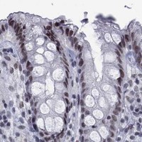 HPA IHC Colon — NPAS3