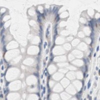 HPA IHC Colon — ULBP1