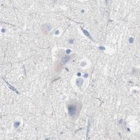 HPA IHC Cerebral cortex — ULBP1
