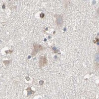 HPA IHC Cerebral cortex — ROCK1