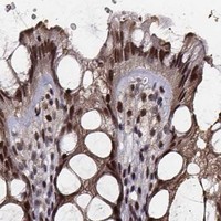 HPA IHC Colon — PPARA