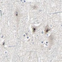 HPA IHC Cerebral cortex — KDM4A
