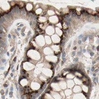 HPA IHC Colon — GALNT3