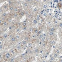 HPA IHC Liver — GALNT3
