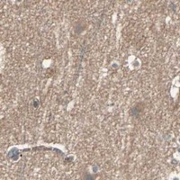 HPA IHC Cerebral cortex — GALNT3