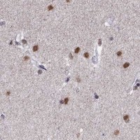 HPA IHC Caudate — HES5