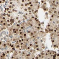 HPA IHC Pancreas — MAP3K4
